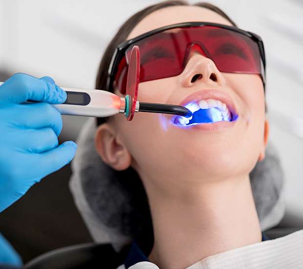 Rockville Professional Teeth Whitening